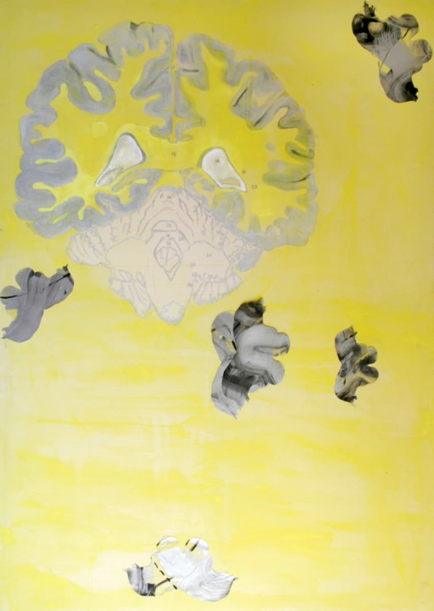 central nervous system 15 dialoguepart 2