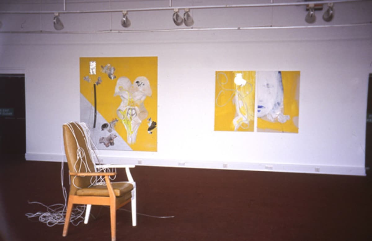 central nervous system 18 img059