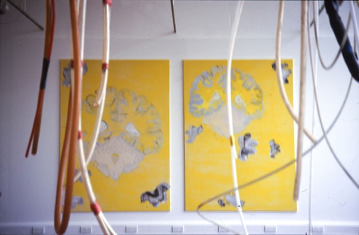 central nervous system 21 img064