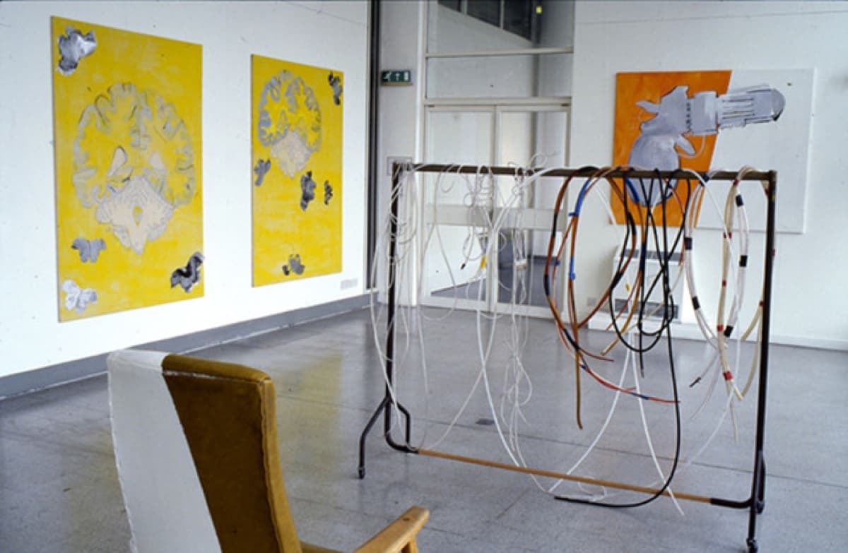 central nervous system 17 img058